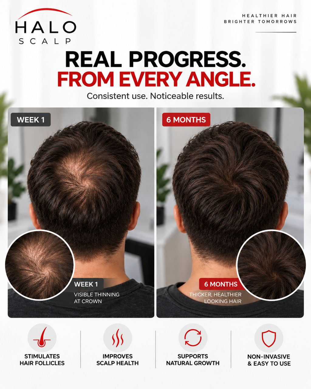 HaloScalp red light therapy cap for scalp care — product photo 5