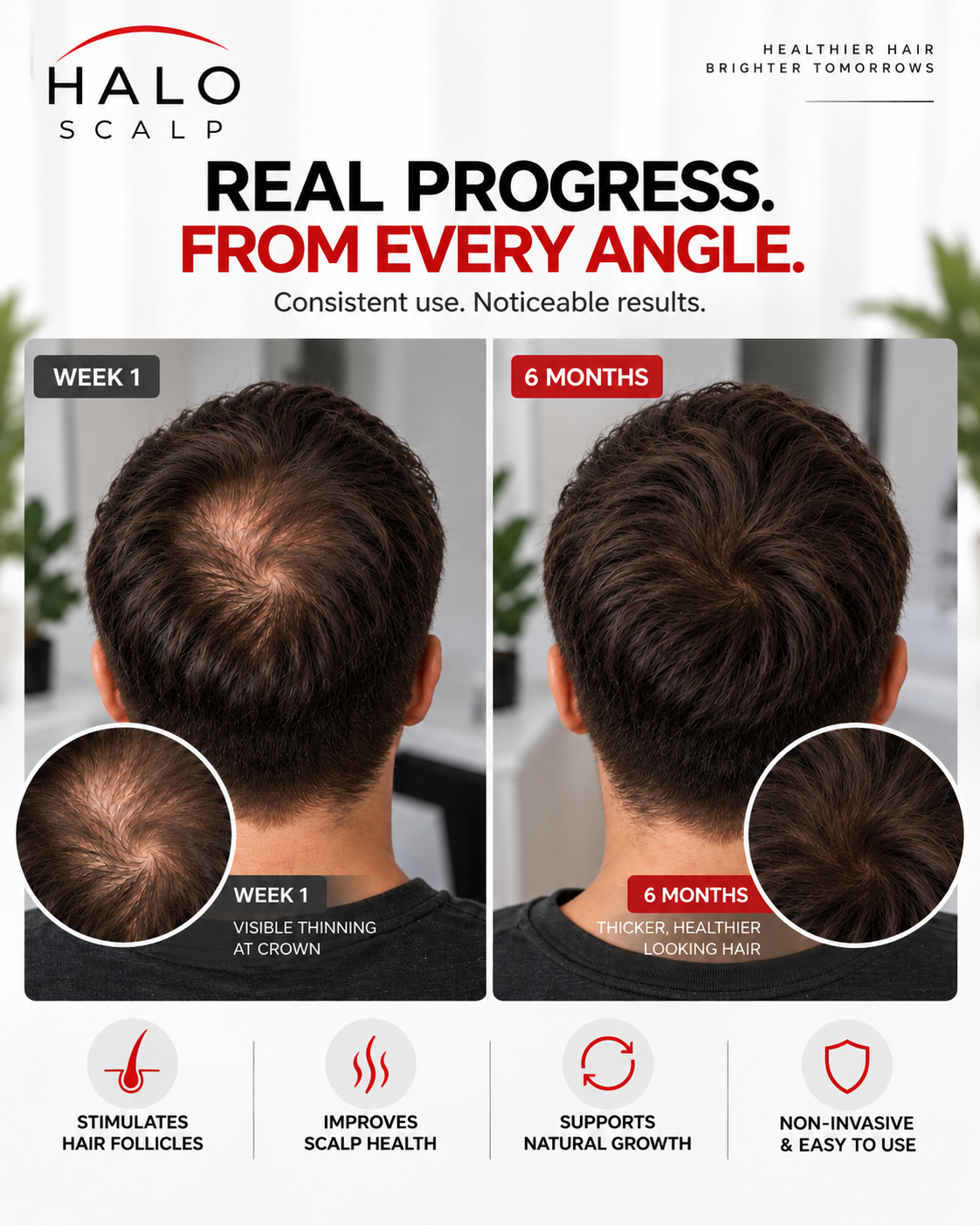HaloScalp red light therapy cap for scalp care — product photo 5